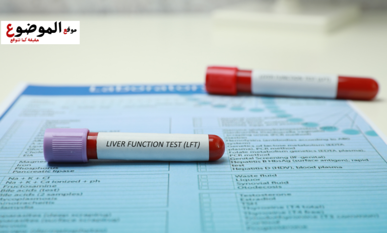 تحاليل الكبد والكلى